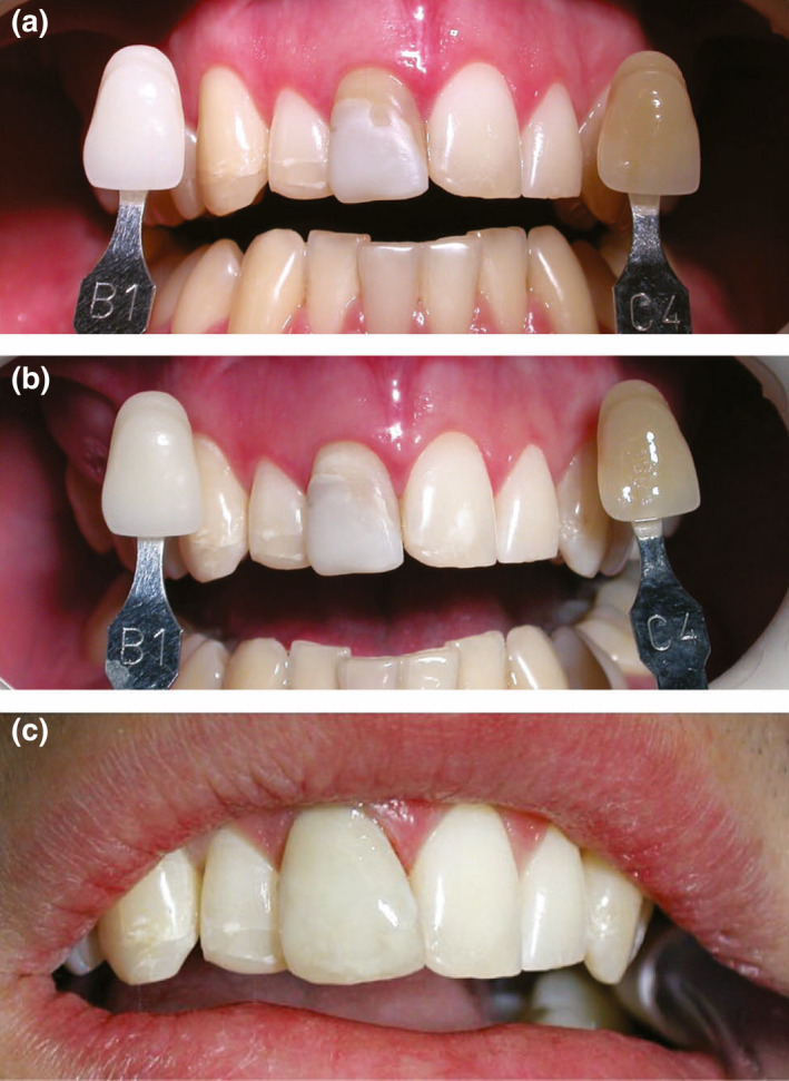 FIGURE 3