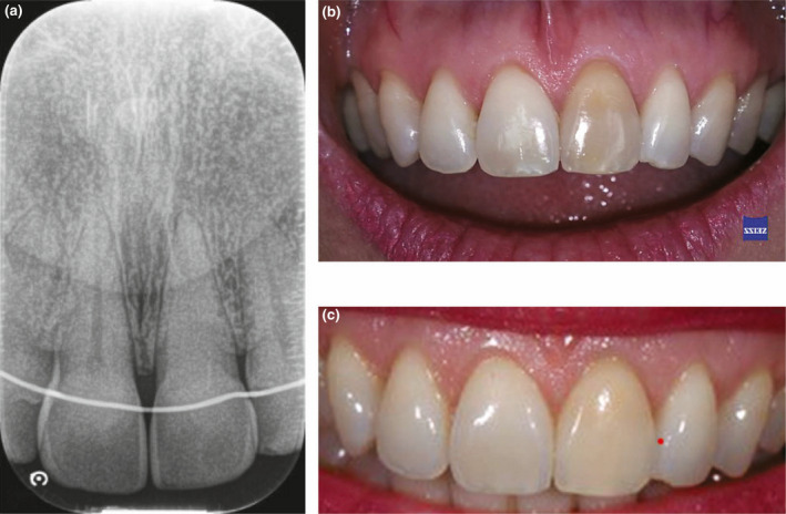 FIGURE 1