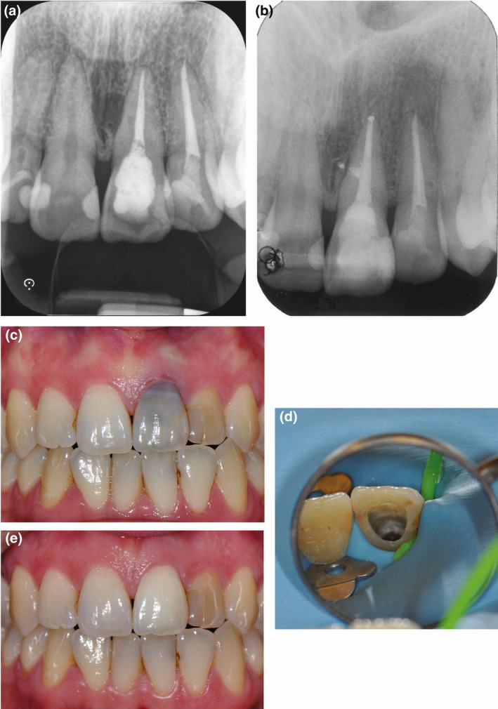 FIGURE 4