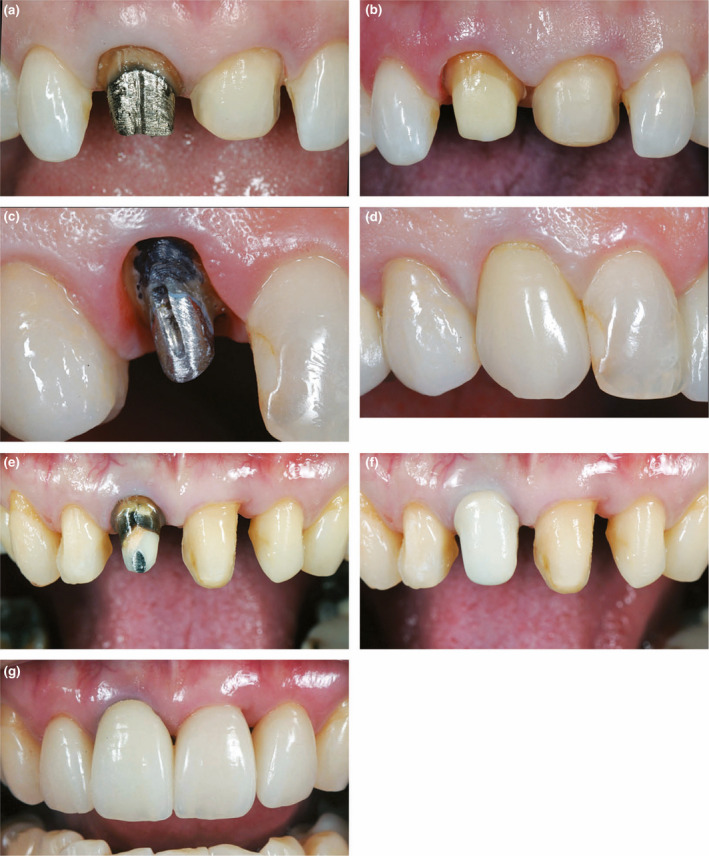 FIGURE 11