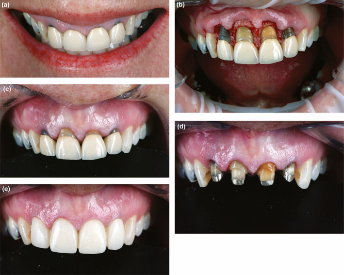 FIGURE 12