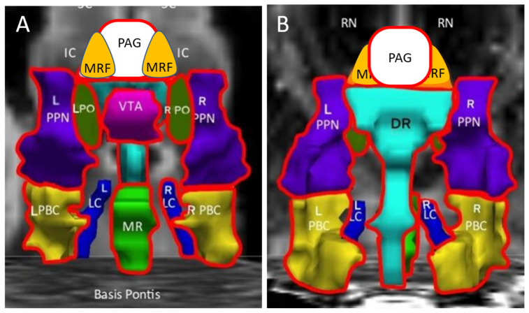 Differential Effects of Exercise on fMRI of the Midbrain Ascending ...