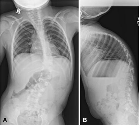 Fig. 2A–B