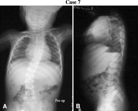 Fig. 1A–B