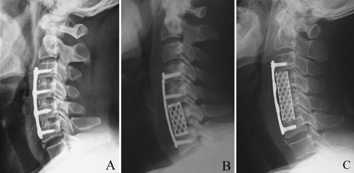 Fig. 1