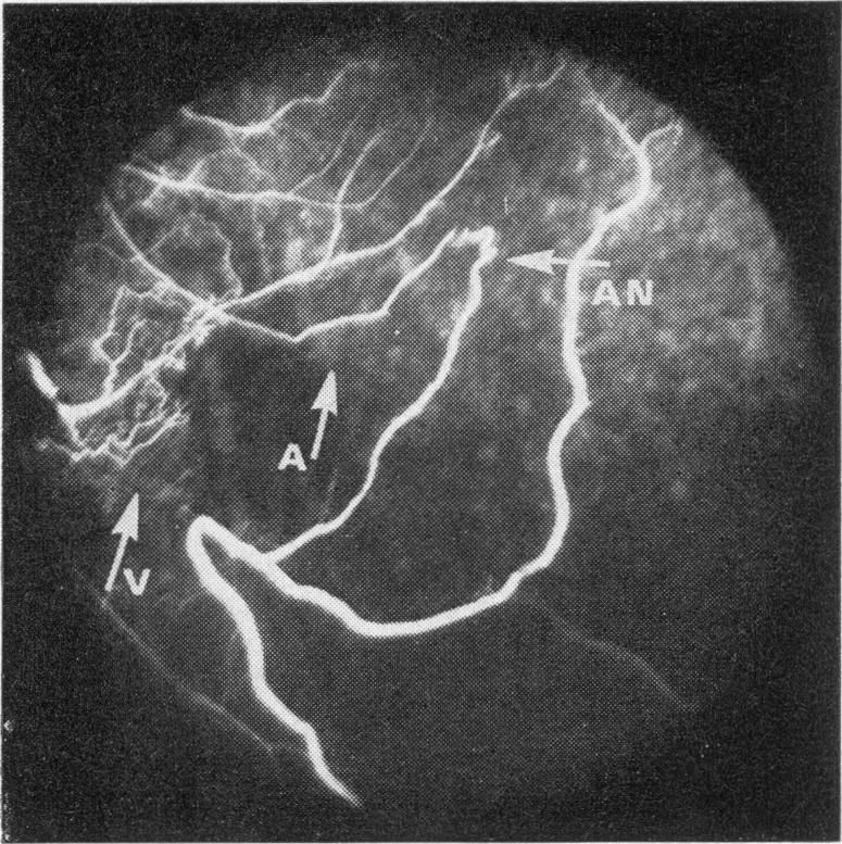 Fig 7