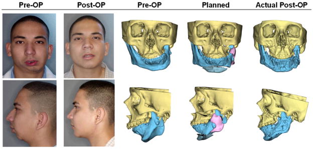 Fig 4