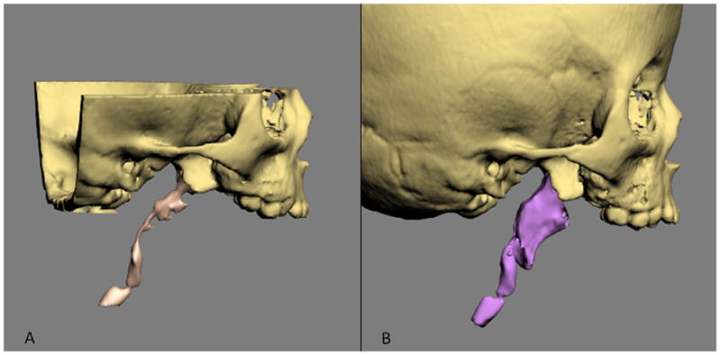 Fig 10