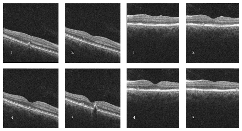 Figure 4