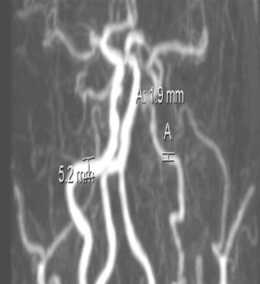 Fig. 3