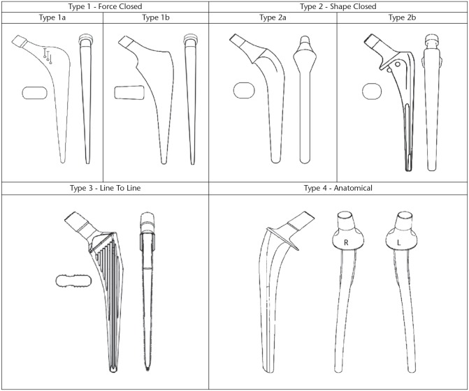 Current concepts and outcomes in cemented femoral stem design and ...