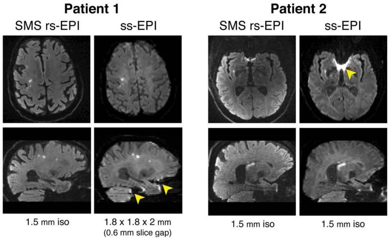 FIG. 6