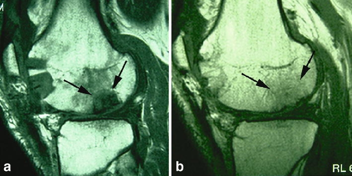 Fig. 4a, b