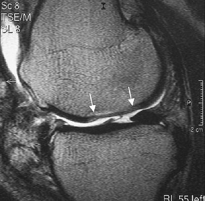 Fig. 13