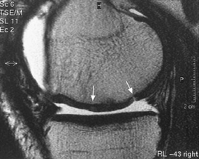 Fig. 9