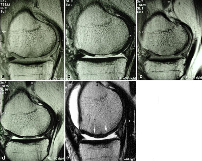 Fig. 12a–e