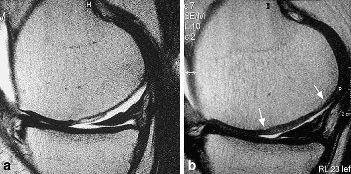 Fig. 14a, b