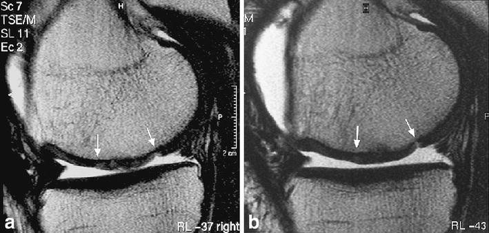 Fig. 11