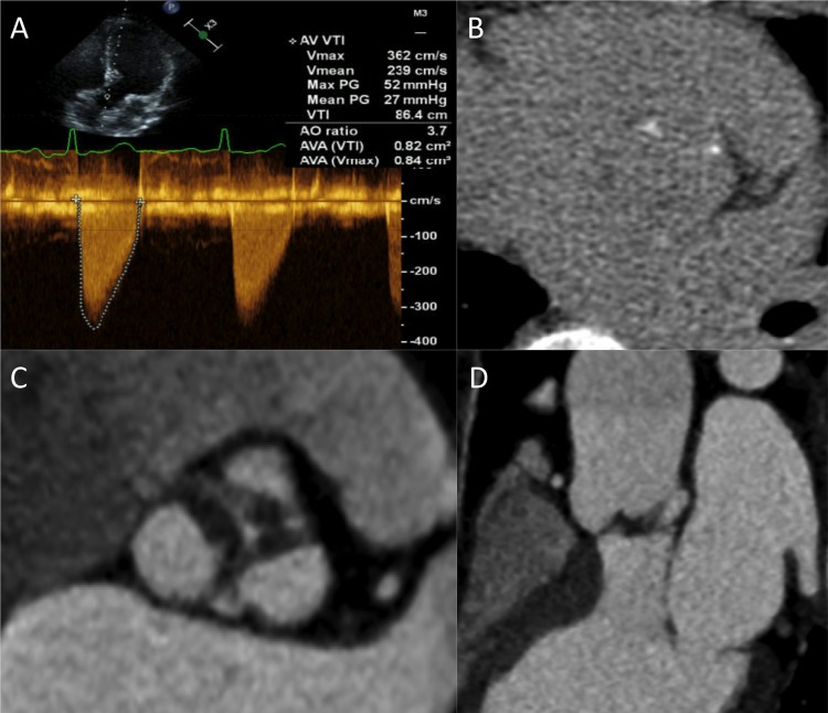 Figure 1