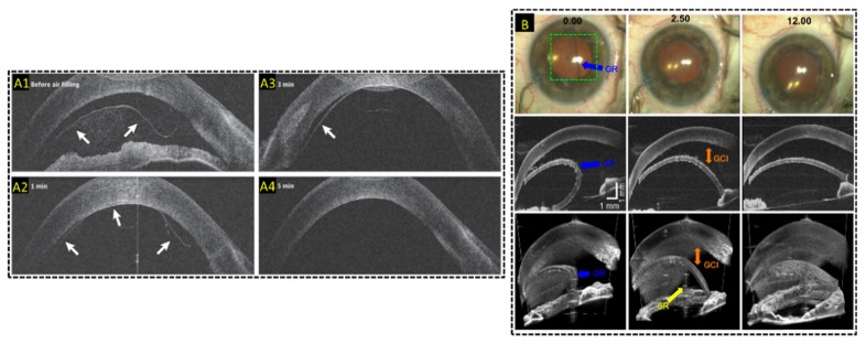 Fig. 13