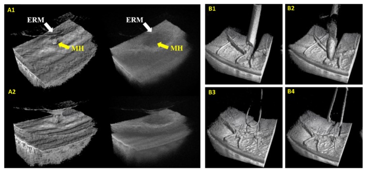 Fig. 7