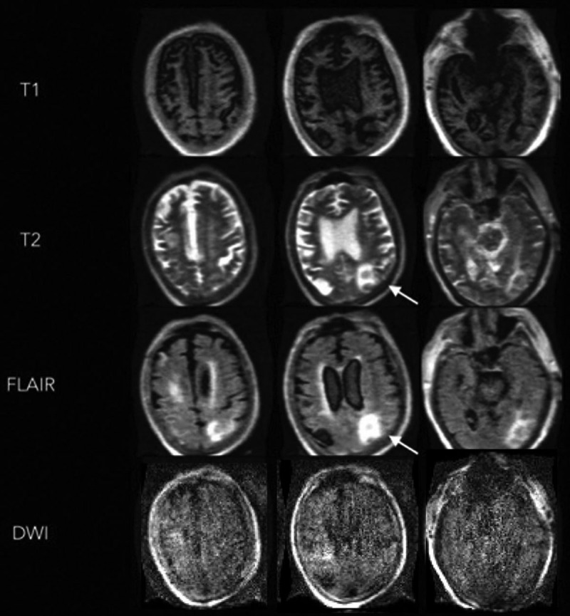 Figure 2.