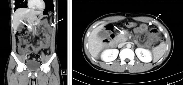 Fig. 1