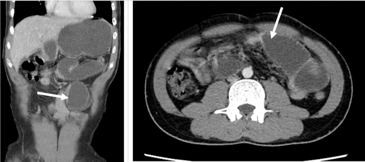 Fig. 2