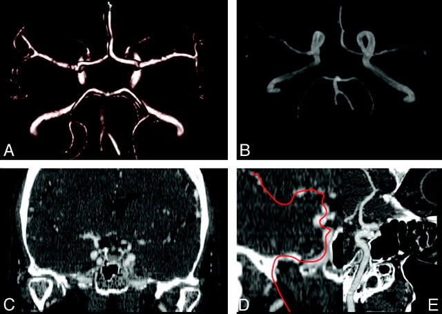 Fig 1.