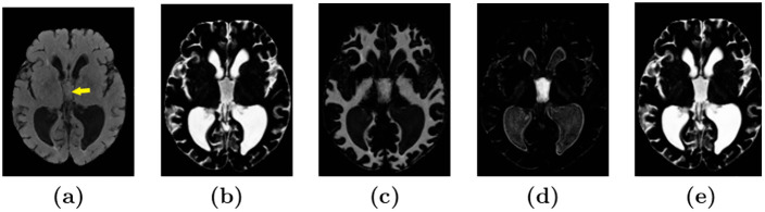 Fig 2