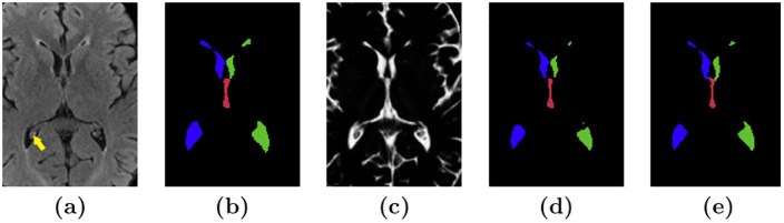 Fig 3