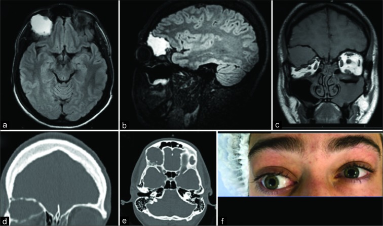 Figure 1: