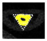 graphic file with name nihms780837t2.jpg