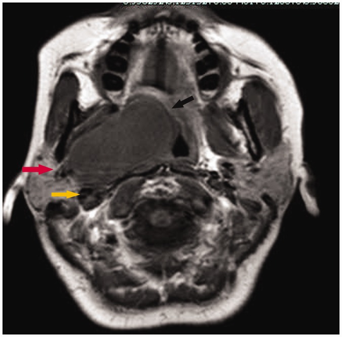 Figure 2.