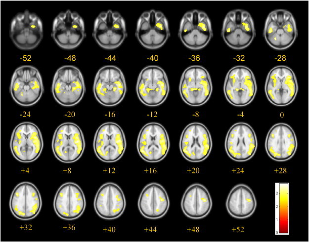 Fig. 1