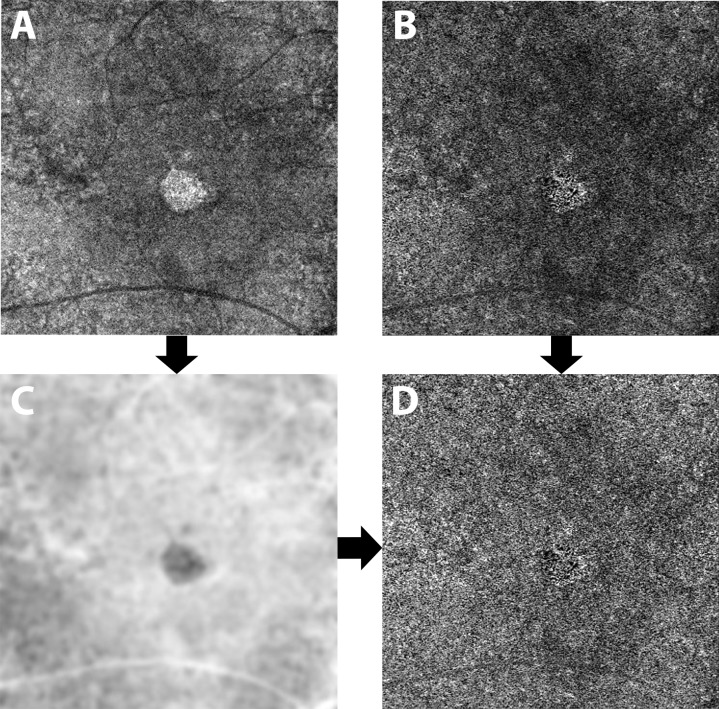 Fig 1