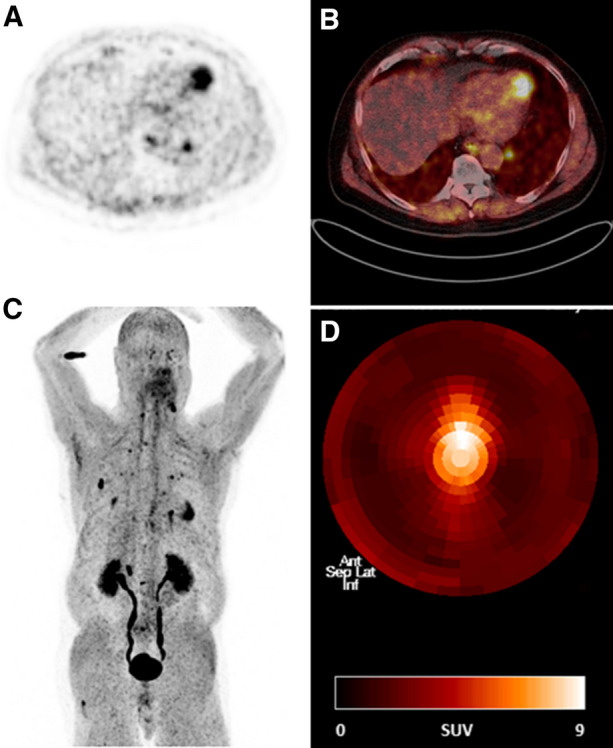 Figure 1