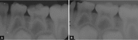 Figs 2A and B: