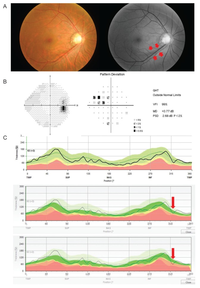 Fig. 3