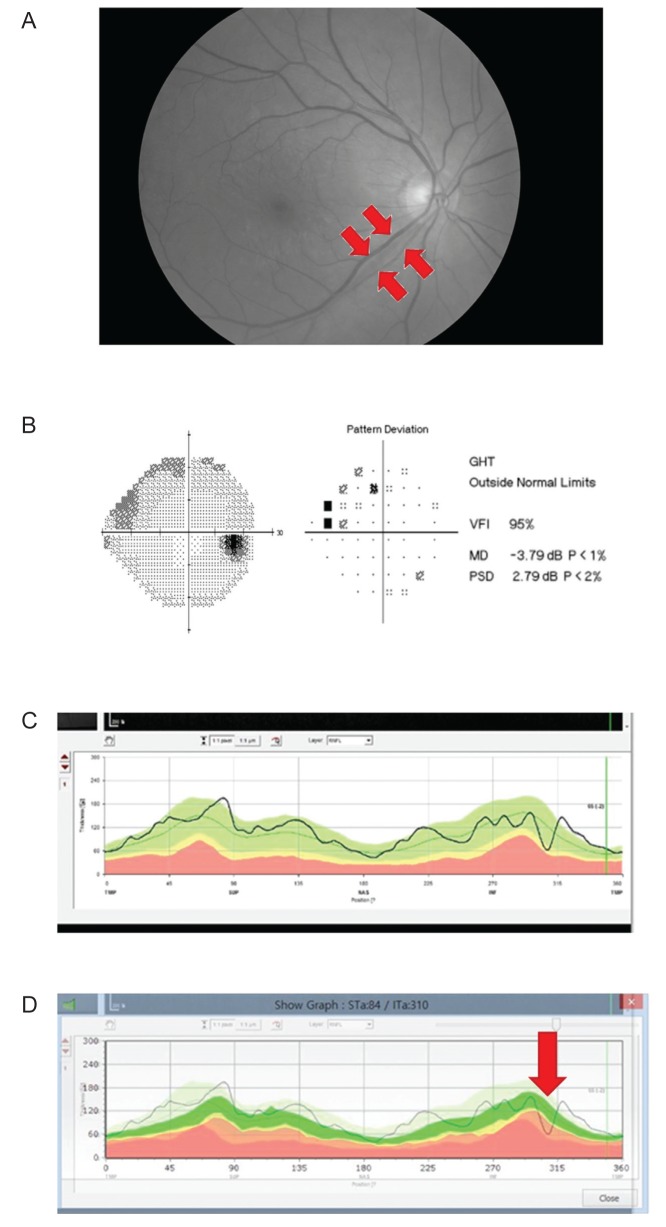 Fig. 2