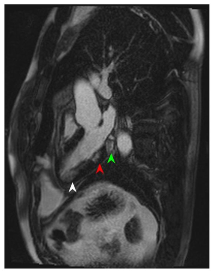 Figure 11