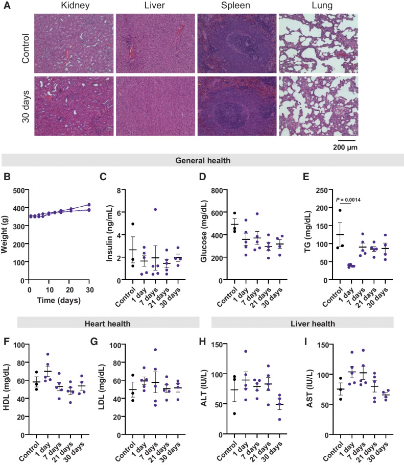 Figure 6. Toxicological analysis of hIL2 in the rat pleura over the span of 30 days. A, Representative images of H&E-stained sections of the kidney, liver, spleen, and lungs of untreated control rats compared with rats sacrificed at 30 days post capsule implant (n = 5). B, Plot tracking the weight of individual rats over the course of treatment. C and D, evaluation of general health through changes in insulin and glucose for each time point. Values are compared to untreated controls. Differences in values were not significant across all groups. P values were acquired using one way ANOVA with Holm–Sidak method for multiple comparisons. E, Evaluation of general health through changes in Triglycerides for each time point. F and G, evaluation of heart health through changes in HDL and LDL levels over time. H and I, Evaluation of liver health through changes in ATL and AST levels over time. All values are compared to untreated controls. Differences in values were not significant across all groups. P values were acquired using one way ANOVA with Holm–Sidak method for multiple comparisons.