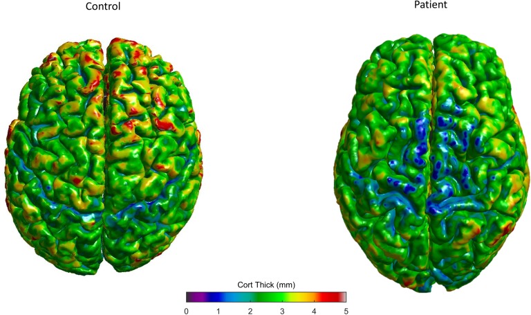 FIGURE 3