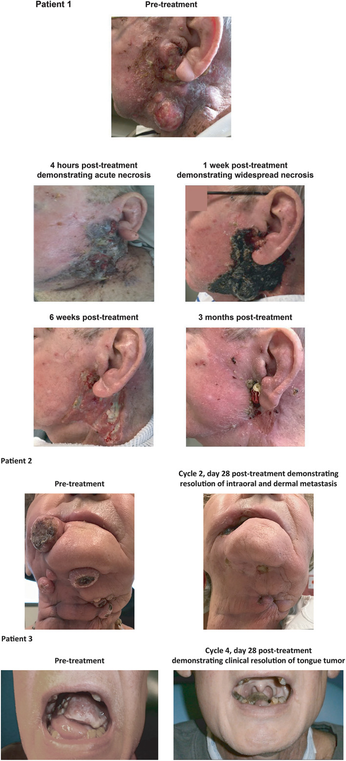 FIGURE 3