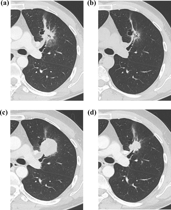 Fig. 1