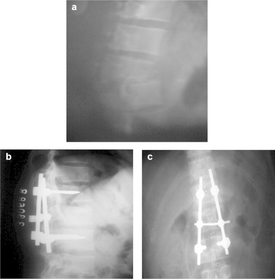 Fig. 1