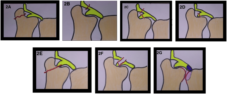 Fig. 2