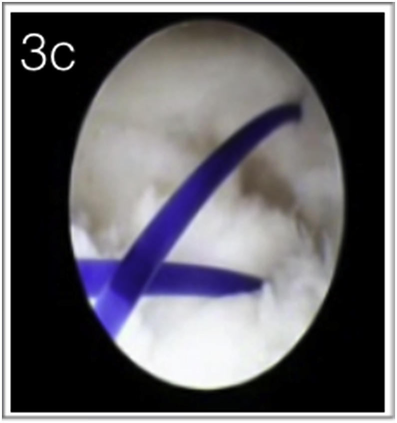 Fig. 3C