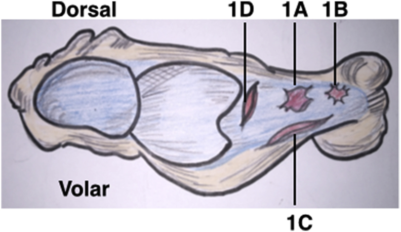 Fig. 1