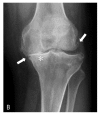 Figure 2B